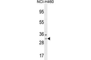 WBSCR27 Antibody (N-term) western blot analysis in NCI-H460 cell line lysates (35 µg/lane). (WBSCR27 抗体  (N-Term))