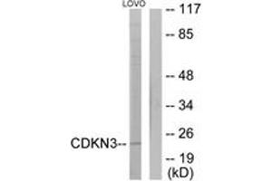 Western blot analysis of extracts from LOVO cells, using CDKN3 Antibody. (CDKN3 抗体  (AA 31-80))
