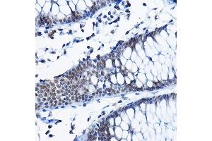 Immunohistochemistry of paraffin-embedded human colon using RPP25 Rabbit pAb (ABIN6133248, ABIN6147176, ABIN6147177 and ABIN6225317) at dilution of 1:100 (40x lens).