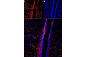 Immunohistochemistry (IHC) image for anti-Transient Receptor Potential Cation Channel, Subfamily C, Member 4 (TRPC4) (AA 458-469), (Extracellular) antibody (ABIN7043822)