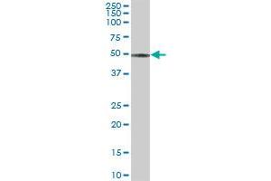 CCM2 MaxPab polyclonal antibody. (CCM2 抗体  (AA 1-444))