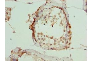 Immunohistochemistry of paraffin-embedded human testis tissue using ABIN7166405 at dilution of 1:100 (ARMT1 (AA 2-250) 抗体)