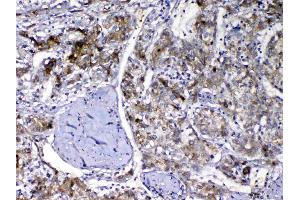 IHC analysis of Vitamin D Binding protein using anti-Vitamin D Binding protein antibody . (Gc (AA 17-256) 抗体)