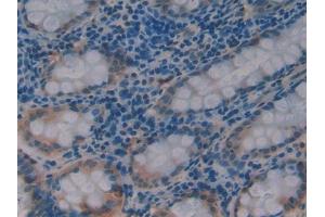 DAB staining on IHC-P; Samples: Human Rectum Tissue (PDK1 抗体  (AA 233-430))