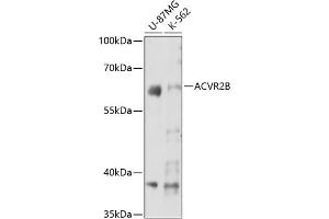 Western blot analysis of extracts of various cell lines, using B antibody (ABIN7265414) at 1:3000 dilution. (ACVR2B 抗体  (AA 50-150))