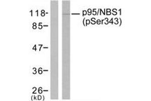 Western blot analysis of extracts from Jurkat cells, using p95/NBS1 (Phospho-Ser343) Antibody. (Nibrin 抗体  (pSer343))