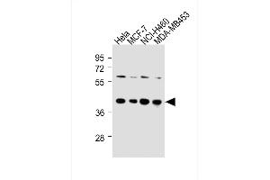 All lanes : Anti-LTM4B-4 Antibody at 1:250 dilution Lane 1: Hela whole cell lysates Lane 2: MCF-7 whole cell lysates Lane 3: NCI- whole cell lysates Lane 4: MDA-M whole cell lysates Lysates/proteins at 20 μg per lane. (LAPTM4B 抗体  (AA 195-209))