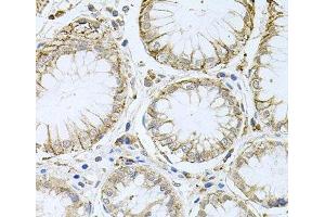 Immunohistochemistry of paraffin-embedded Human stomach using HPS1 Polyclonal Antibody at dilution of 1:100 (40x lens).