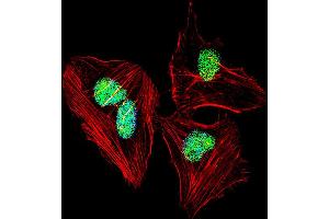 Fluorescent confocal image of Hela cell stained with NFIA Antibody . (NFIA 抗体  (C-Term))