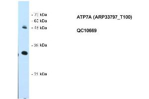 WB Suggested Anti-ATP7A Antibody Titration: 0. (ATP7A 抗体  (N-Term))