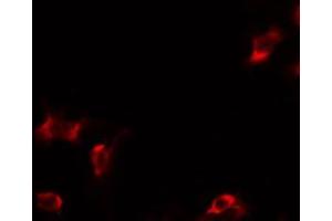 ABIN6269348 staining HepG2 by IF/ICC. (BIK 抗体)