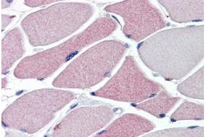 Immunohistochemistry (IHC) image for anti-Transient Receptor Potential Cation Channel, Subfamily A, Member 1 (TRPA1) (N-Term) antibody (ABIN1104836)
