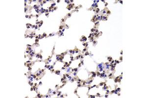 Immunohistochemistry of paraffin-embedded Mouse lung using CMPK1 antibody at dilution of 1:100 (x400 lens). (Cytidine Monophosphate (UMP-CMP) Kinase 1, Cytosolic (CMPK1) 抗体)