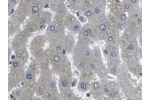 Immunohistochemistry (IHC) image for anti-Actin Related Protein 2/3 Complex, Subunit 4, 20kDa (ARPC4) (AA 3-165) antibody (ABIN7437920)