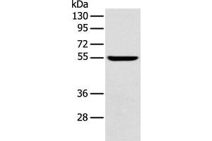 Western blot analysis of Mouse brain tissue using FOXG1 Polyclonal Antibody at dilution of 1:550 (FOXG1 抗体)
