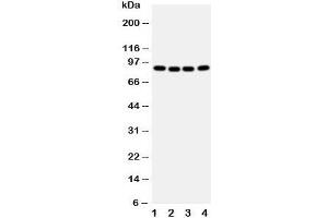 Western blot testing of CUL2 antibody and human samples 1:  A431;  2: SMMC-7721;  3: HeLa;  4: COLO320 cell lysate. (Cullin 2 抗体  (Middle Region))