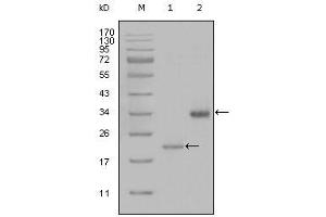 Western Blot showing LPA antibody used against truncated LPA-His recombinant protein (1) and truncated Trx-LPA (aa4330-4521) recombinant protein (2). (LPA 抗体)