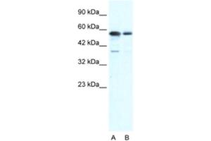 Western Blotting (WB) image for anti-X-Ray Repair Complementing Defective Repair in Chinese Hamster Cells 6 (XRCC6) antibody (ABIN2460867) (XRCC6 抗体)