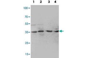 Western blot analysis of tissue lysates with MTA1 polyclonal antibody . (MTA1 抗体  (C-Term))