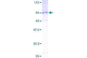 SERBP1 Protein (AA 1-402) (GST tag)