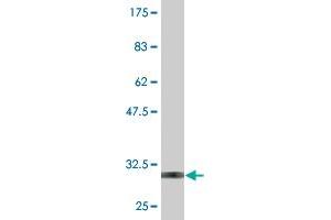 Western Blot detection against Immunogen (31.