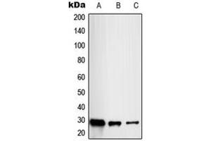 Western blot analysis of RAB20 expression in HL60 (A), HeLa (B), HuvEc (C) whole cell lysates.