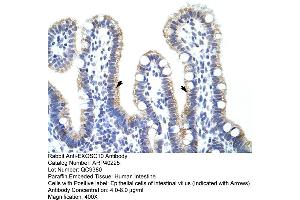 Rabbit Anti-EXOSC10 Antibody  Paraffin Embedded Tissue: Human Intestine Cellular Data: Epithelial cells of intestinal villas Antibody Concentration: 4. (EXOSC10 抗体  (C-Term))