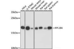 Western blot analysis of extracts of various cell lines using RPL18A Polyclonal Antibody at dilution of 1:1000. (RPL18A 抗体)