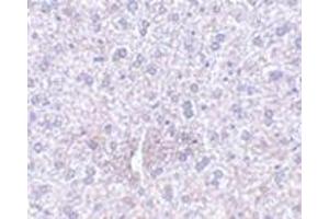 Immunohistochemistry of TEM7 in mouse liver tissue with this product at 2. (PLXDC1 抗体  (Center))