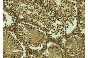 ABIN6277431 at 1/100 staining Mouse testis tissue by IHC-P. (RAD50 抗体  (Internal Region))