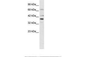 Image no. 2 for anti-POU Domain, Class 4, Transcription Factor 3 (POU4F3) (AA 211-260) antibody (ABIN202275) (POU4F3 抗体  (AA 211-260))