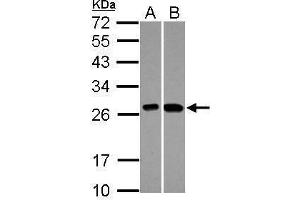 WB Image Sample (30 ug of whole cell lysate) A: A549 B: HepG2 12% SDS PAGE antibody diluted at 1:1000 (KNP-1 (Center) 抗体)