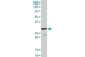 GSTZ1 monoclonal antibody (M01), clone 1G12. (GSTZ1 抗体  (AA 109-216))