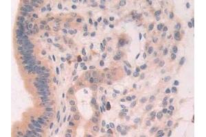 Detection of XDH in Mouse Uterus Tissue using Polyclonal Antibody to Xanthine Dehydrogenase (XDH)