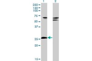 Western Blotting (WB) image for anti-Zinc Finger Protein 266 (ZNF266) (AA 274-347) antibody (ABIN599521) (ZNF266 抗体  (AA 274-347))