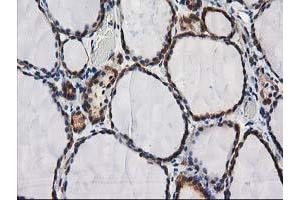 Image no. 1 for anti-Destrin (Actin Depolymerizing Factor) (DSTN) antibody (ABIN1497910) (Destrin 抗体)