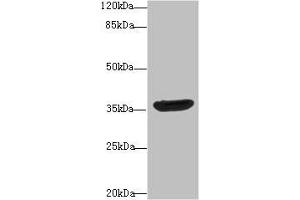 Western blot All lanes: DNAJB2 antibody at 10 μg/mL + A431 whole cell lysate Secondary Goat polyclonal to rabbit IgG at 1/10000 dilution Predicted band size: 36, 31 kDa Observed band size: 36 kDa (DNAJB2 抗体  (AA 2-324))