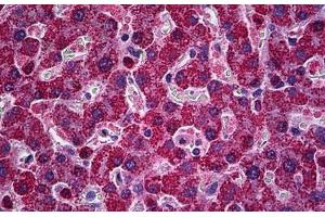Human Liver: Formalin-Fixed, Paraffin-Embedded (FFPE) (PIM1 抗体  (AA 1-314))