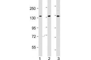 Western blot testing of AATK antibody at 1:2000 dilution. (AATK 抗体  (AA 46-74))