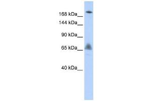 VPS8 antibody used at 1 ug/ml to detect target protein. (VPS8 抗体)