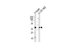 Western blot analysis of lysates from human heart tissue lysate, U-251 MG cell line (from left to right), using AKTIP Antibody (C-term) (ABIN1881052 and ABIN2838362). (AKTIP 抗体  (C-Term))