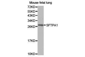 Western Blotting (WB) image for anti-Surfactant Protein A1 (SFTPA1) antibody (ABIN1874759) (Surfactant Protein A1 抗体)