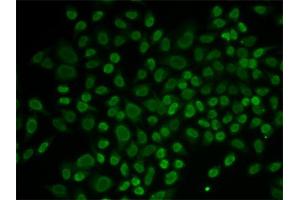 Immunofluorescence analysis of MCF-7 cells using RAD54L2 antibody. (ARIP4 抗体)