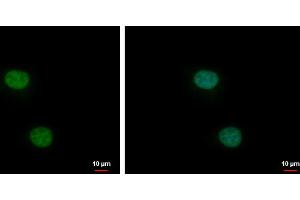 ICC/IF Image XLF antibody [N3C3] detects XLF protein at nucleus by immunofluorescent analysis. (NHEJ1 抗体)