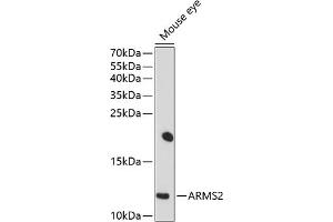 Western blot analysis of extracts of mouse eye, using  antibody (ABIN6129951, ABIN6137123, ABIN6137124 and ABIN6214318) at 1:1000 dilution. (ARMS2 抗体  (AA 1-107))