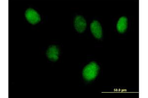 Immunofluorescence (IF) image for anti-Signal Transducer and Activator of Transcription 6, Interleukin-4 Induced (STAT6) (AA 1-847) antibody (ABIN520550)