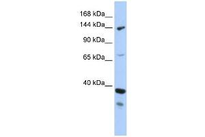 DHX37 antibody used at 1 ug/ml to detect target protein. (DHX37 抗体)