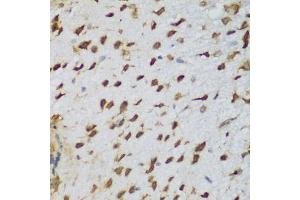 Immunohistochemistry of paraffin-embedded mouse brain using NCL antibody (ABIN5975400) at dilution of 1/200 (40x lens). (Nucleolin 抗体)
