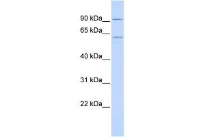 WB Suggested Anti-CUGBP2 Antibody Titration:  0. (CELF2 抗体  (N-Term))