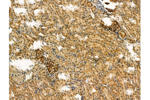 ABIN6263913 and ABIN6266606 at 1/100 staining Rat kidney tissue by IHC-P. (Osteopontin 抗体  (C-Term))